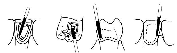 Diamantový brousek TF-S31