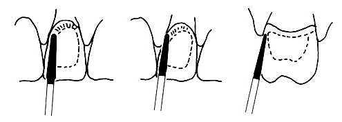 Diamantový brousek TR-19