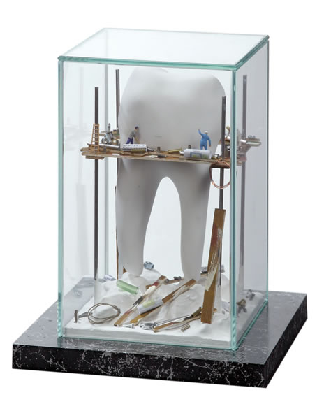 Vitrína Staveniště zubu