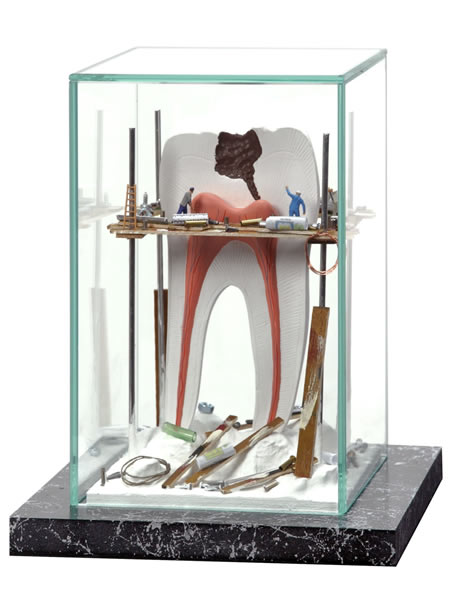 Vitrína Staveniště zubu s nervem