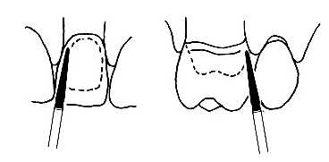 Diamantový brousek TC-21F