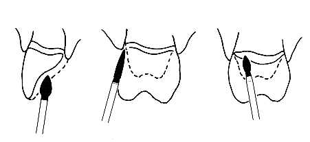 Diamantový brousek FO-22F
