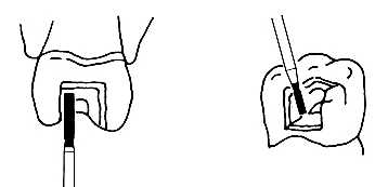 Diamantový brousek SF-11