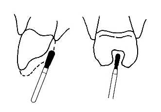 Diamantový brousek EX-20