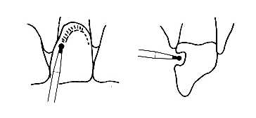 Diamantový brousek BR-S45