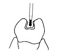 Diamantový brousek BC-43