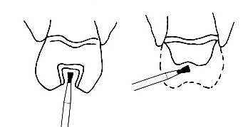 Diamantový brousek SI-S48
