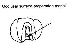 Diamantový brousek CR-11F