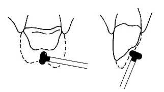 Diamantový brousek WR-13