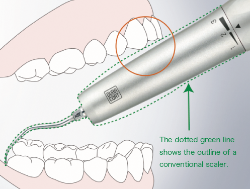 Vzduchový scaler S970